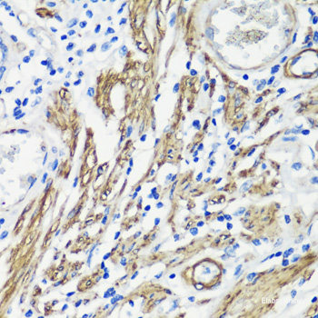 Immunohistochemistry of paraffin-embedded Mouse brain using ACOX1 Polyclonal Antibody at dilution of 1:100 (40x lens).