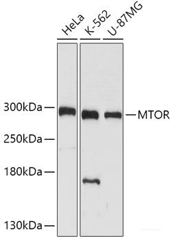 Immunohistochemistry of paraffin-embedded Human esophagus using FOSL2 Polyclonal Antibody at dilution of 1:100 (40x lens).