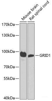 Immunohistochemistry of paraffin-embedded Human stomach using ATAD3A Polyclonal Antibody at dilution of 1:100 (40x lens).