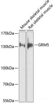Immunofluorescence analysis of GFP-RNF168 transgenic U2OS cells using Phospho-p53(S15) Polyclonal Antibody