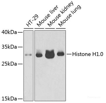 Western blot analysis of extracts of various cell lines using PMM2 Polyclonal Antibody at dilution of 1:1000.