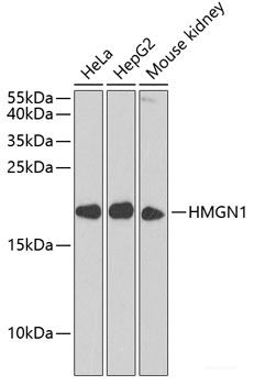 Immunofluorescence analysis of MCF7 cells using PCBD1 Polyclonal Antibody