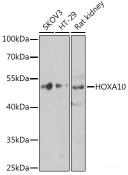 Western blot analysis of extracts of various cell lines using VAV2 Polyclonal Antibody at dilution of 1:3000.