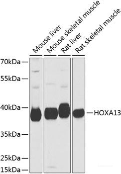 Immunofluorescence analysis of U2OS cells using Phospho-p53(S9) Polyclonal Antibody