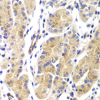 Immunohistochemistry of paraffin-embedded Rat brain using IL33 Polyclonal Antibody at dilution of 1:100 (40x lens).