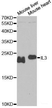 Western blot analysis of extracts of various cell lines using TGM3 Polyclonal Antibody at dilution of 1:1000.