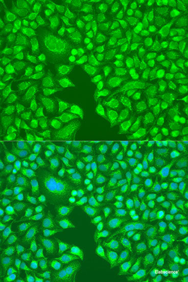 Immunofluorescence analysis of C6 cells using INPP5B Polyclonal Antibody at dilution of 1:100. Blue: DAPI for nuclear staining.