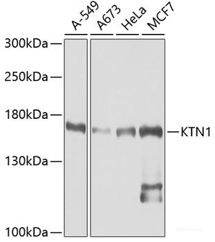 Immunohistochemistry of paraffin-embedded Mouse lung using CYP2C9 Polyclonal Antibody at dilution of 1:100 (40x lens).
