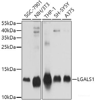 Immunofluorescence analysis of A-549 cells using DHFR Polyclonal Antibody