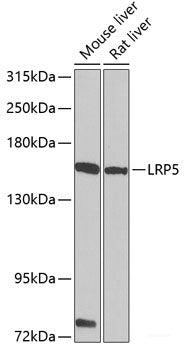 Western blot analysis of extracts of various cell lines using ATG13 Polyclonal Antibody at dilution of 1:1000.