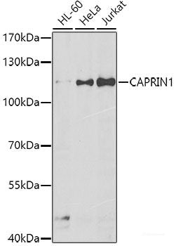 Immunohistochemistry of paraffin-embedded Rat kidney using CDH6 Polyclonal Antibody at dilution of 1:100 (40x lens).