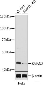 Western blot analysis of extracts of various cell lines using ANGPT1 Polyclonal Antibody at dilution of 1:1000.