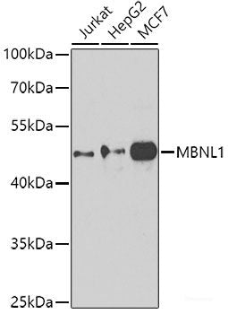 Immunohistochemistry of paraffin-embedded Human prostate using ARL6 Polyclonal Antibody at dilution of 1:100 (40x lens).