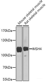 Western blot analysis of extracts of Rat liver using PLA2G6 Polyclonal Antibody at dilution of 1:1000.
