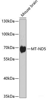 Immunohistochemistry of paraffin-embedded Rat liver using DDX39B Polyclonal Antibody at dilution of 1:100 (40x lens).