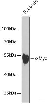 Immunohistochemistry of paraffin-embedded Rat pancreas using ETV1 Polyclonal Antibody at dilution of 1:100 (40x lens).
