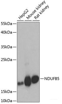 Western blot analysis of extracts of Mouse lung using PPP4R4 Polyclonal Antibody at dilution of 1:1000.