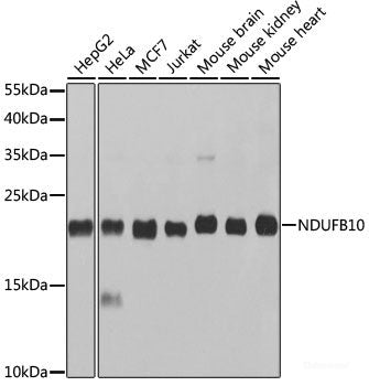 Immunofluorescence analysis of A549 cells using SERPINA10 Polyclonal Antibody