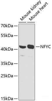 Immunohistochemistry of paraffin-embedded Human lung cancer using Phospho-Histone H3(T11) Polyclonal Antibody at dilution of 1:100 (40x lens).