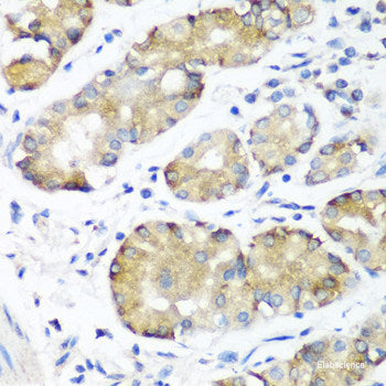 Western blot analysis of extracts from normal (control) and ROCK1 knockout (KO) HeLa cells using ROCK1 Polyclonal Antibody at dilution of 1:1000.
