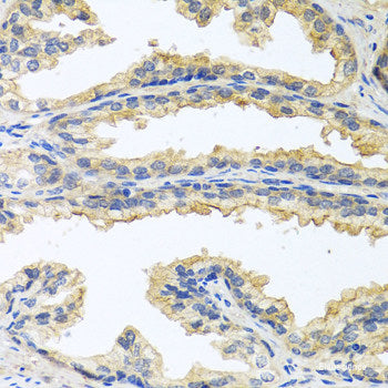Immunohistochemistry of paraffin-embedded Rat lung using PIP Polyclonal Antibody at dilution of 1:100 (40x lens).