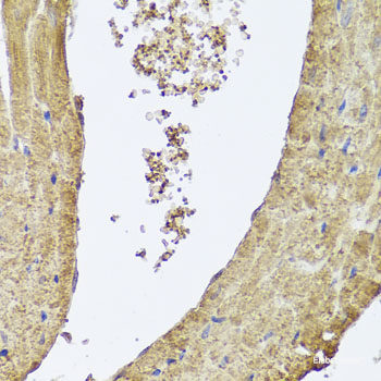 Immunofluorescence analysis of Rat brain using CORO1A Polyclonal Antibody at dilution of 1:100 (40x lens). Blue: DAPI for nuclear staining.