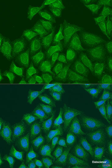 Western blot analysis of extracts of various cell lines using CSTF2 Polyclonal Antibody at dilution of 1:3000.