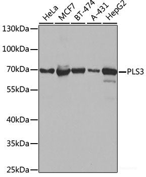 Western blot analysis of extracts of Jurkat cells using UBE2L6 Polyclonal Antibody.