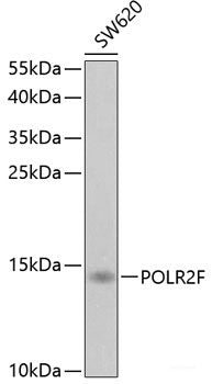 Immunohistochemistry of paraffin-embedded Human colon using PTPRA Polyclonal Antibody at dilution of 1:100 (40x lens).