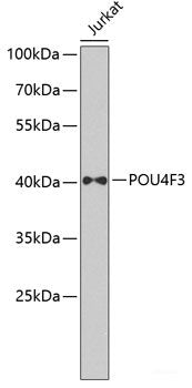 Immunohistochemistry of paraffin-embedded Human stomach using BPGM Polyclonal Antibody at dilution of 1:100 (40x lens).