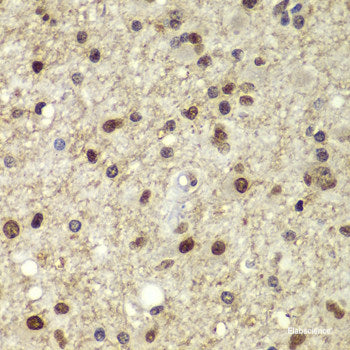 Immunohistochemistry of paraffin-embedded Human prostate using CFD Polyclonal Antibody at dilution of 1:100 (40x lens).