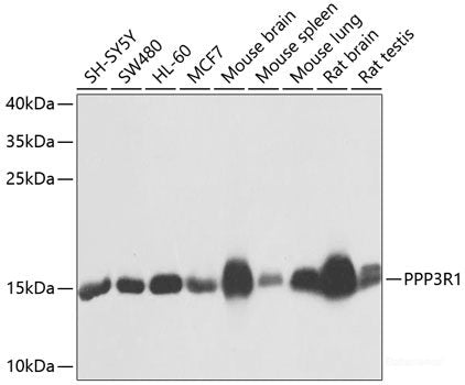 Western blot analysis of extracts of 22Rv1 cells using TRHDE Polyclonal Antibody at dilution of 1:1000.