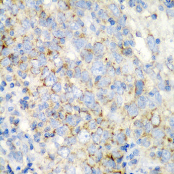 Immunohistochemistry of paraffin-embedded Rat kidney using DAP Polyclonal Antibody at dilution of 1:200 (40x lens).