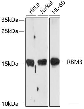 Immunohistochemistry of paraffin-embedded Human stomach using TNFRSF10A Polyclonal Antibody at dilution of 1:100 (40x lens).