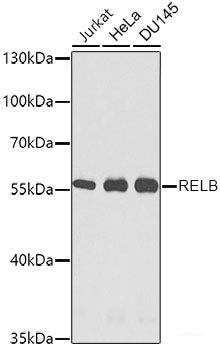 Immunofluorescence analysis of THP-1 cells using CR1 Polyclonal Antibody at dilution of 1:100. Blue: DAPI for nuclear staining.