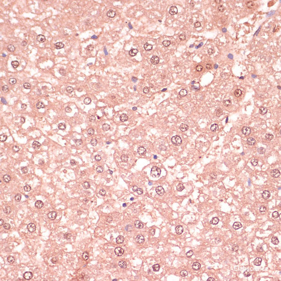 Immunohistochemistry of paraffin-embedded Mouse liver using ULk1 Polyclonal Antibody at dilution of 1:100 (40x lens).