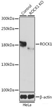 Immunofluorescence analysis of Rat brain using MEGF10 Polyclonal Antibody at dilution of 1:100. Blue: DAPI for nuclear staining.