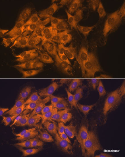 Western blot analysis of extracts of various cell lines using HSP90B1 Polyclonal Antibody.