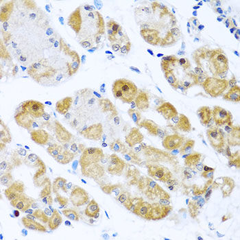Immunofluorescence analysis of U2OS cells using AFF1 Polyclonal Antibody