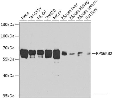 Immunofluorescence analysis of U-2 OS cells using RPL34 Polyclonal Antibody at dilution of 1:100. Blue: DAPI for nuclear staining.