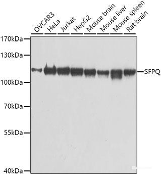 Western blot analysis of extracts of BT-474 cells using RNF138 Polyclonal Antibody at dilution of 1:1000.