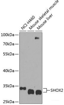 Western blot analysis of extracts of various cell lines using RIPK4 Polyclonal Antibody at dilution of 1:1000.