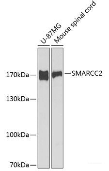 Immunohistochemistry of paraffin-embedded Human prostate using Wnt5a Polyclonal Antibody at dilution of 1:100 (40x lens).