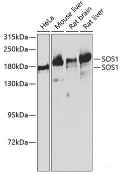 Western blot analysis of extracts of HepG2 cells using NDUFV3 Polyclonal Antibody.