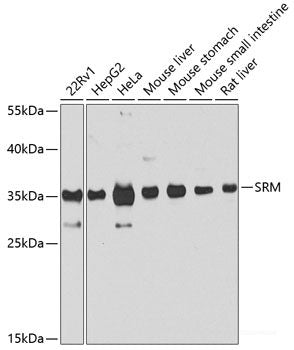 Immunohistochemistry of paraffin-embedded Human stomach using HLA-DMB Polyclonal Antibody at dilution of 1:100 (40x lens).