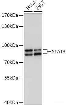Immunofluorescence analysis of HUVEC cells using VEGF Polyclonal Antibody at dilution of 1:100 (40x lens). Blue: DAPI for nuclear staining.