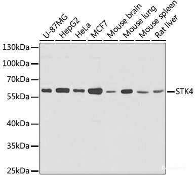 Immunofluorescence analysis of U2OS cells using DHX58 Polyclonal Antibody at dilution of 1:100. Blue: DAPI for nuclear staining.