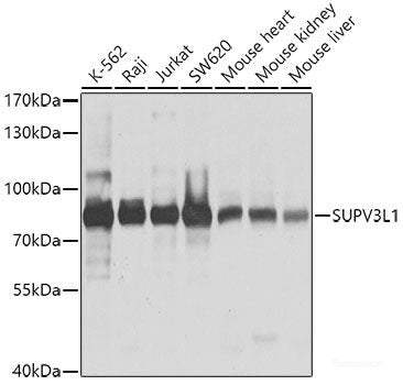 Western blot analysis of extracts from Jurkat cells using Phospho-eIF2α(S51) Polyclonal Antibody.