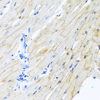 Immunofluorescence analysis of HeLa cells using HOXB9 Polyclonal Antibody at dilution of 1:100 (40x lens). Blue: DAPI for nuclear staining.