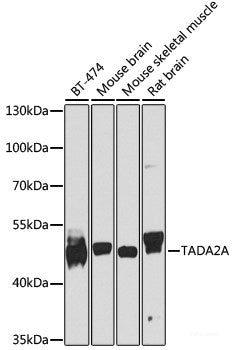 Western blot analysis of extracts of various cell lines using VPS33B Polyclonal Antibody at dilution of 1:1000.